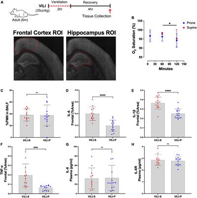 Prone positioning reduces frontal and hippocampal neuronal dysfunction in a murine model of ventilator-induced lung injury